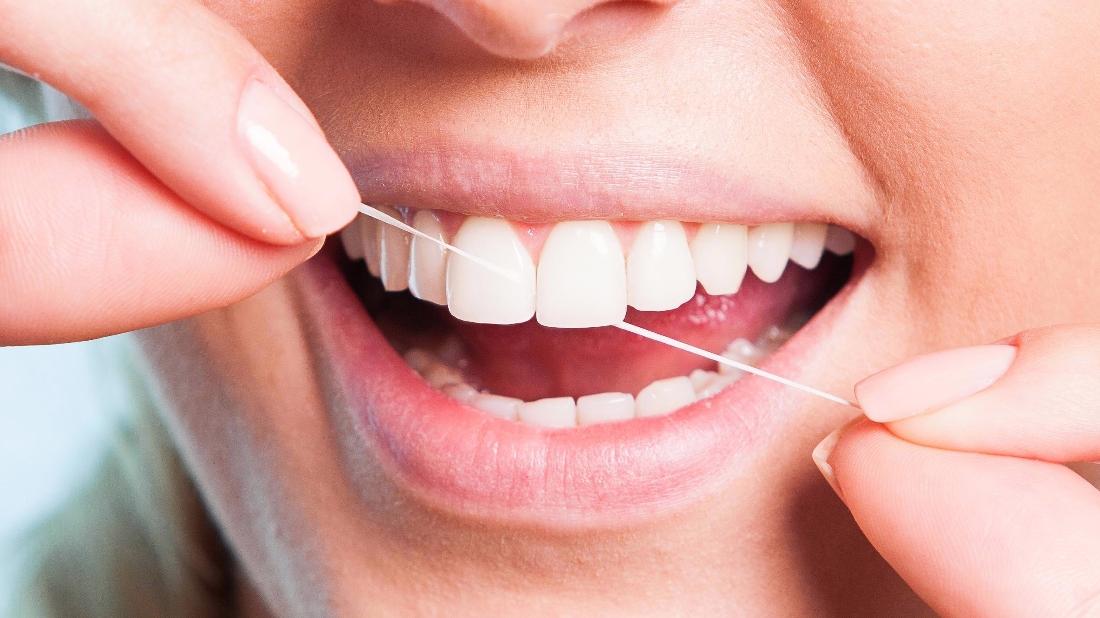 Chesterfield MO Dentist Flossing Techniques
