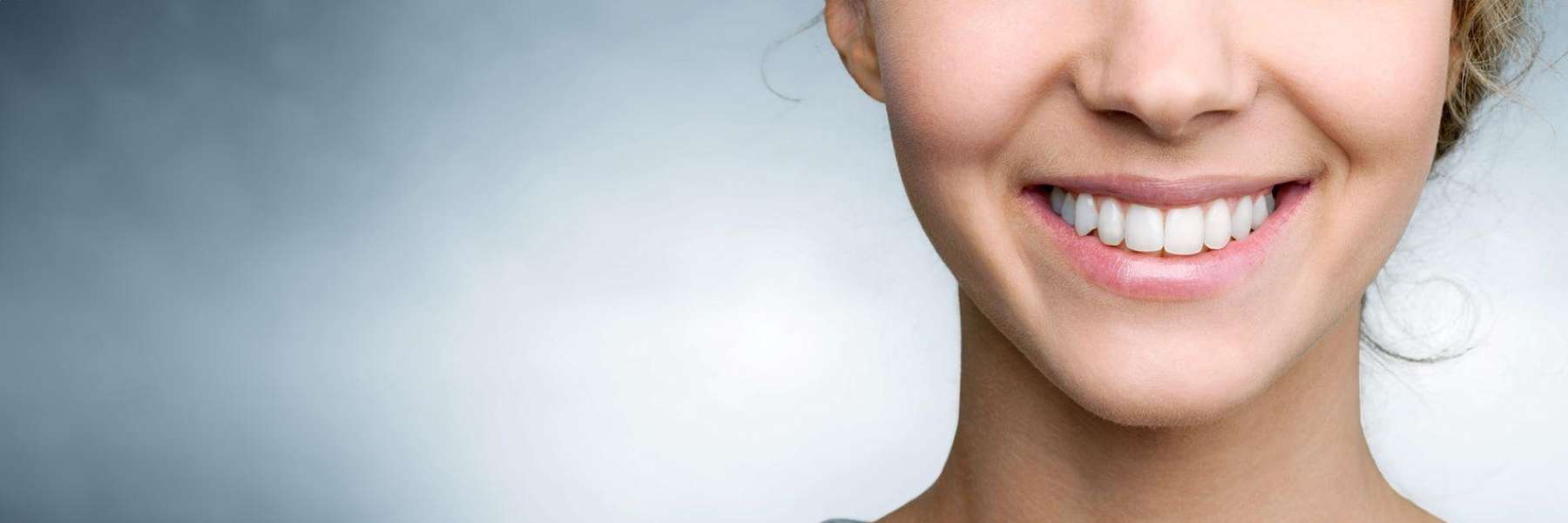 close-up of straight teeth in Chesterfield MO | Inman Aligner treatment