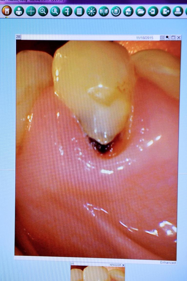 Computer Visualization | Dentist Chesterfield MO