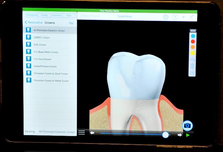 iPad Education | Chesterfield MO Dentist